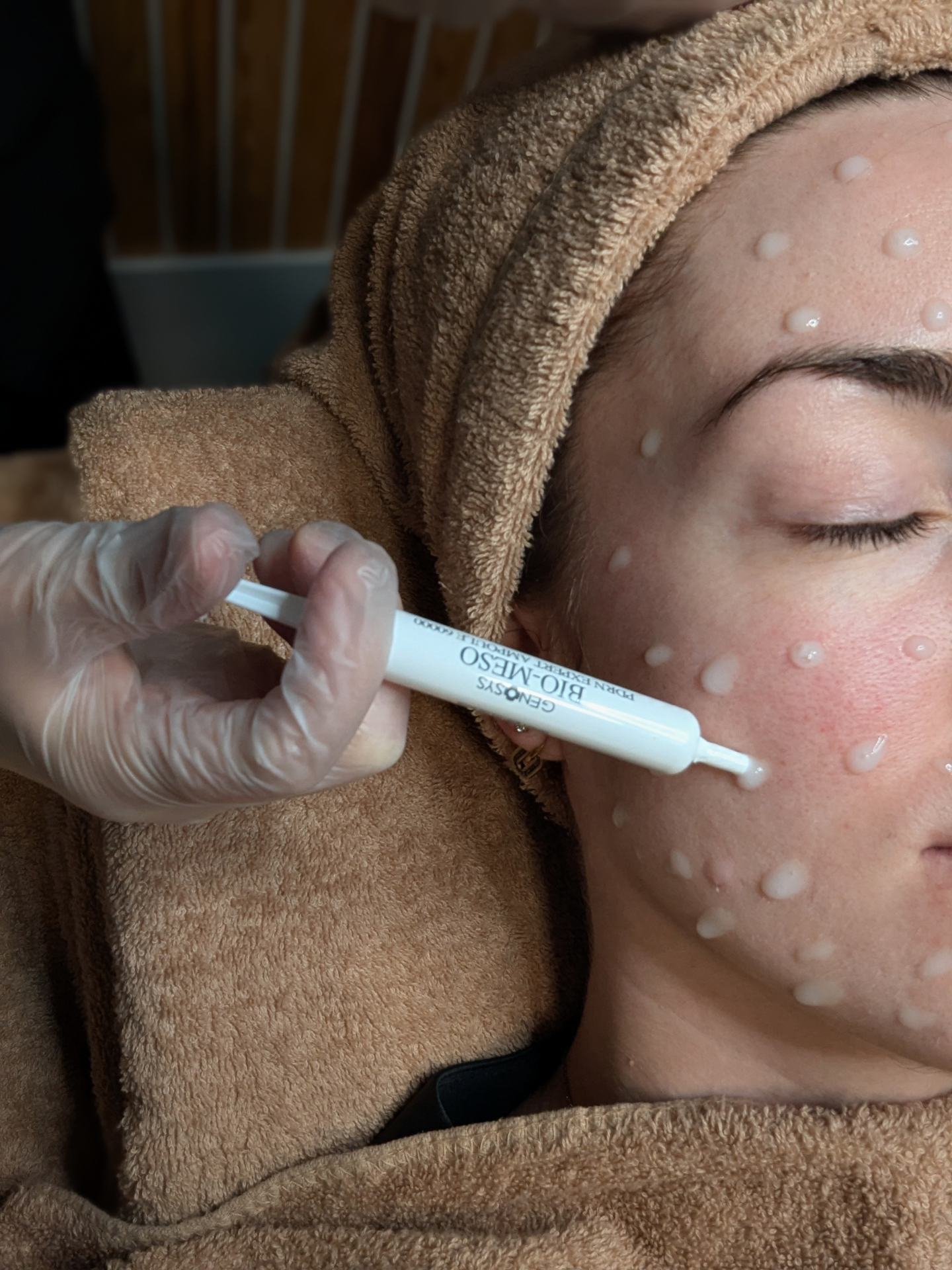Genosys Bio-Meso PDRN facial treatment at Haku Dublin